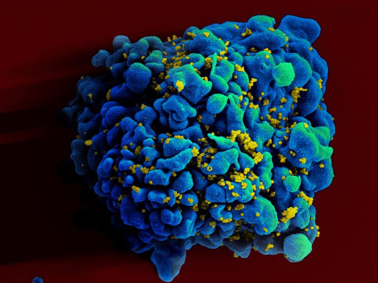 Photo of HIV Infected H9 T Cell