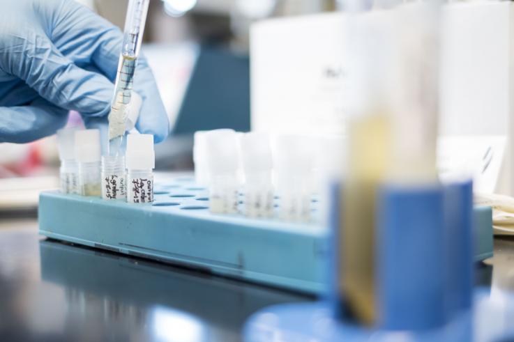 Photo of a diagnostic test at the Fred Hutchinson Cancer Research Center in Seattle, WA