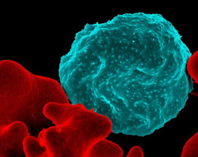 Photo of a red blood cell infected with malaria parasites
