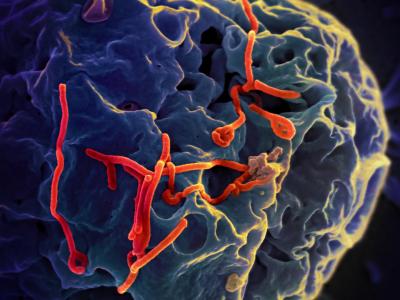 Photo of Ebola virus budding from the surface of an African green monkey kidney epithelial cell.
