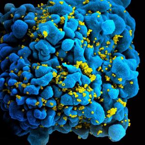 Photo of HIV infected T Cell