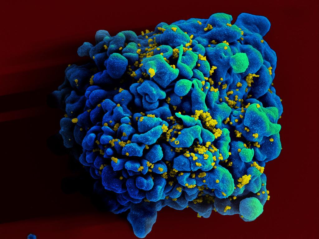 Photo of HIV Infected H9 T Cell